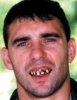 Billy_Bob_Teeth_W_Gold_Tooth.jpg